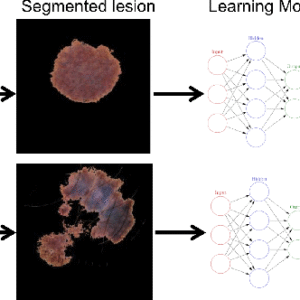 Detection of skin cancer using deep learning and image processing