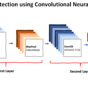CNN based Pneumonia detection